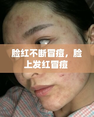脸红不断冒痘,脸上发红冒痘